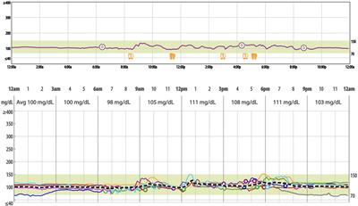 Continuous glucose monitoring reveals similar glycemic variability in individuals with obesity despite increased HOMA-IR